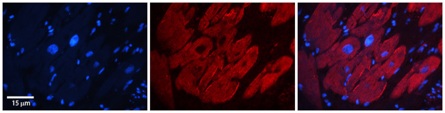 G3BP1 Antibody in Immunohistochemistry (Paraffin) (IHC (P))