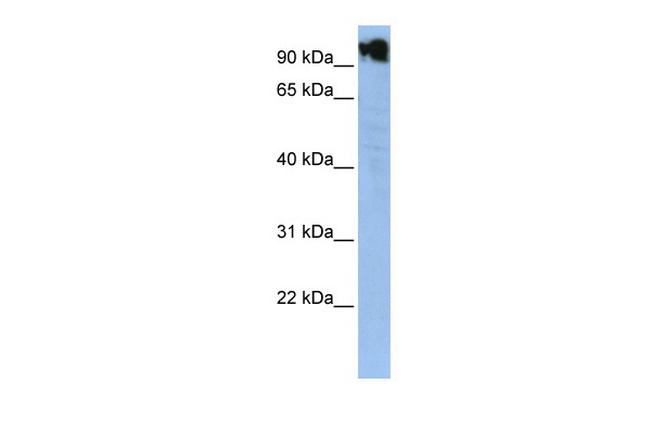 ZFY Antibody in Western Blot (WB)