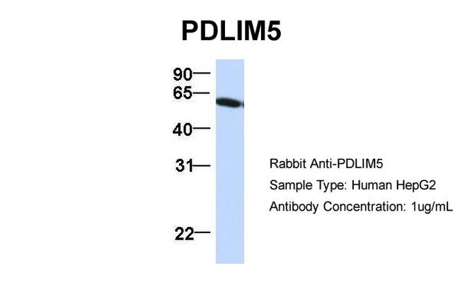 PDLIM5 Antibody in Western Blot (WB)