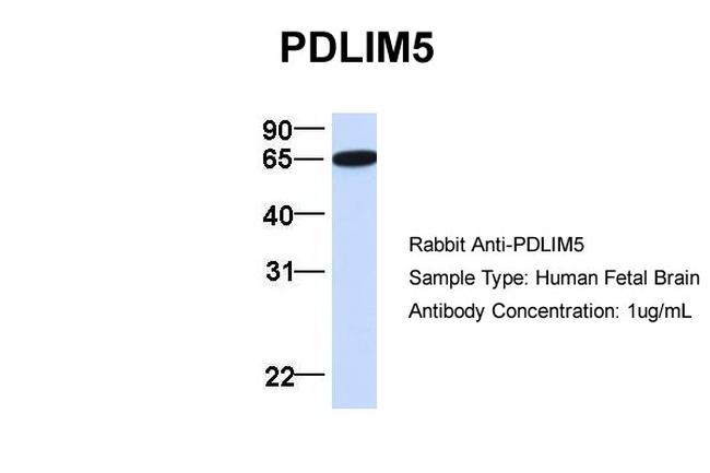 PDLIM5 Antibody in Western Blot (WB)