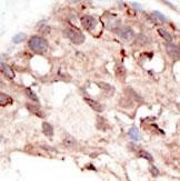 SUV39H2 Antibody in Immunohistochemistry (Paraffin) (IHC (P))