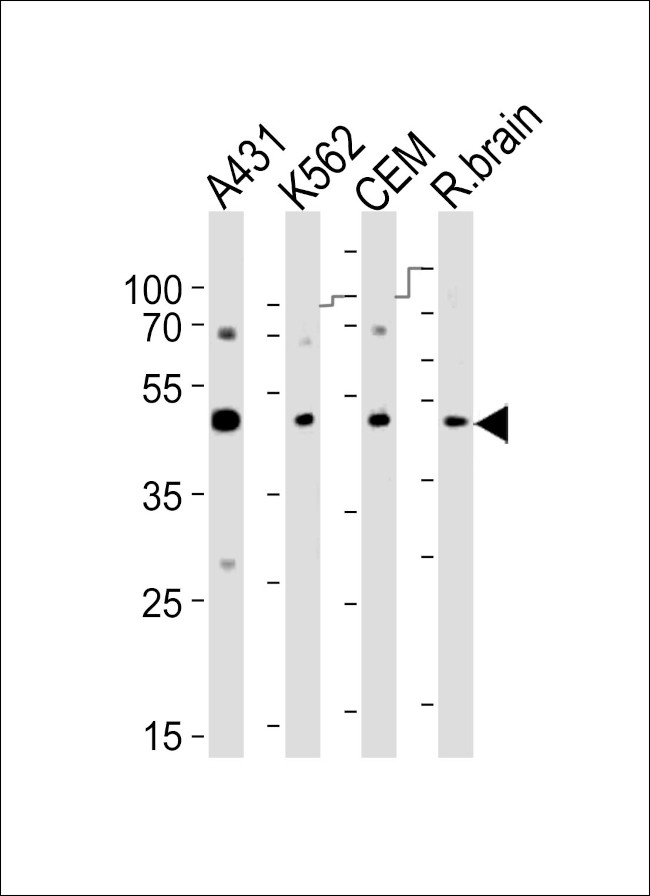 SUV39H2 Antibody in Western Blot (WB)