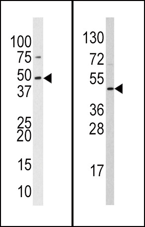 SUV39H2 Antibody in Western Blot (WB)