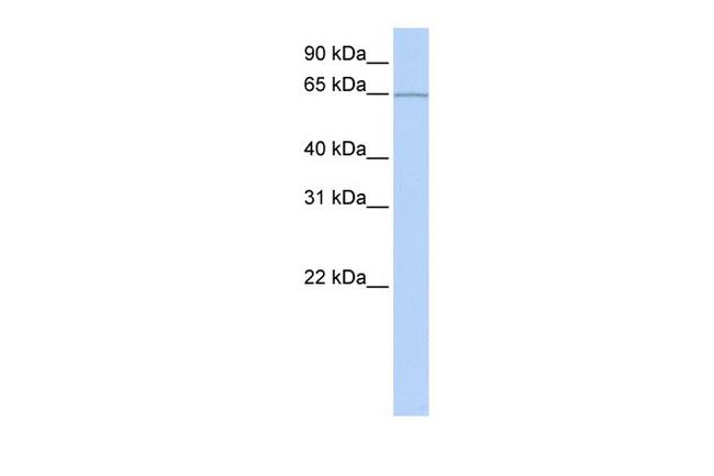 KIAA0020 Antibody in Western Blot (WB)