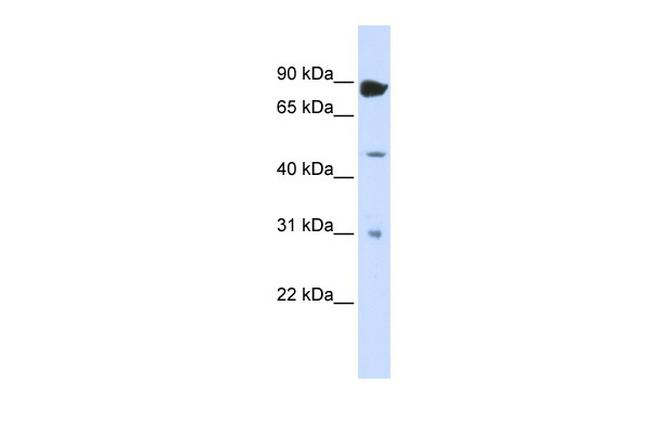 ADARB1 Antibody in Western Blot (WB)