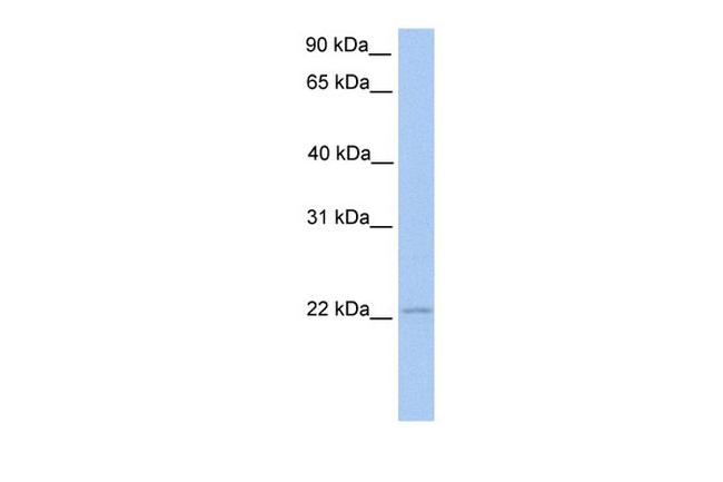 ISG20 Antibody in Western Blot (WB)