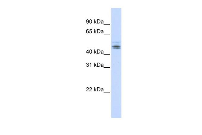 RDBP Antibody in Western Blot (WB)