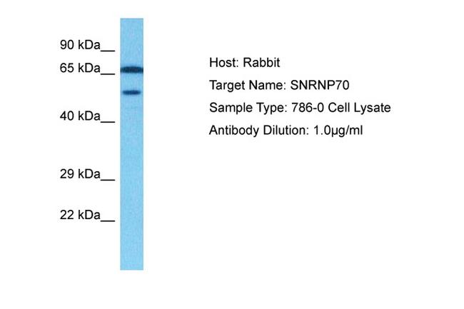 SNRNP70 Antibody in Western Blot (WB)