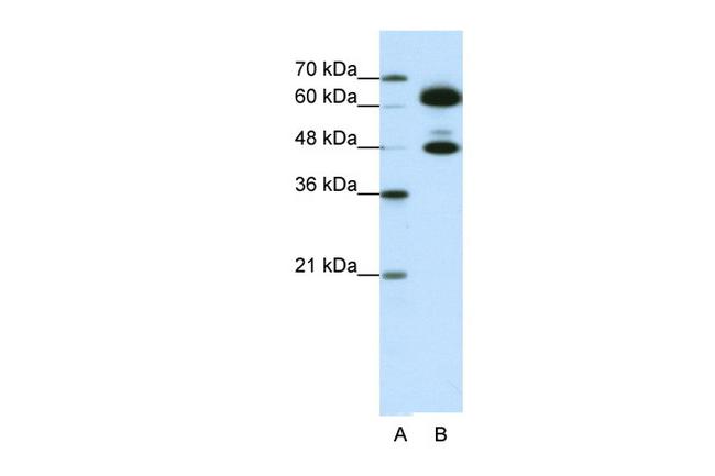 SNRNP70 Antibody in Western Blot (WB)