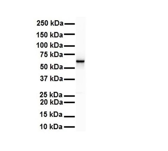 SNRNP70 Antibody in Western Blot (WB)