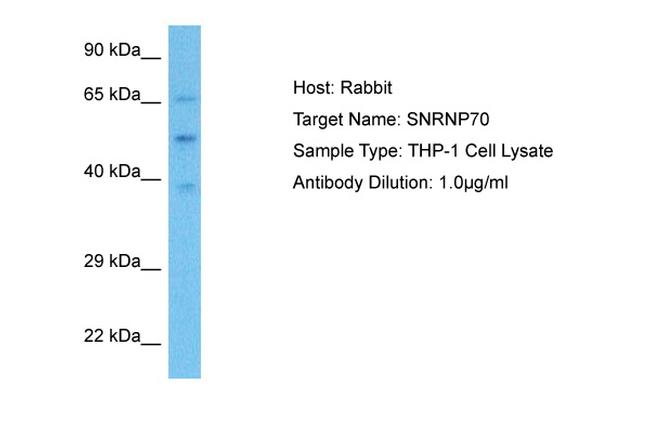 SNRNP70 Antibody in Western Blot (WB)