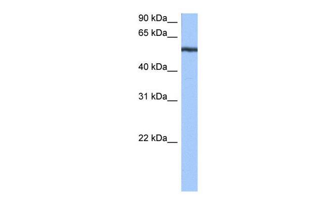 YARS Antibody in Western Blot (WB)