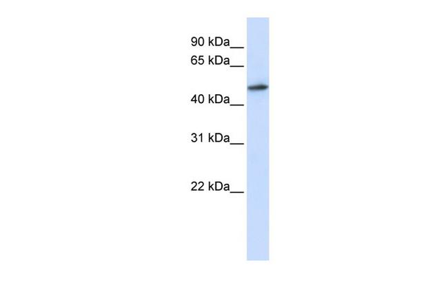 RNMT Antibody in Western Blot (WB)