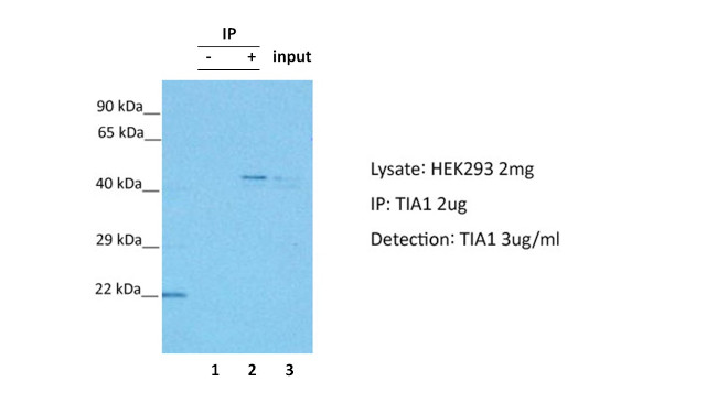 TIA-1 Antibody in Immunoprecipitation (IP)