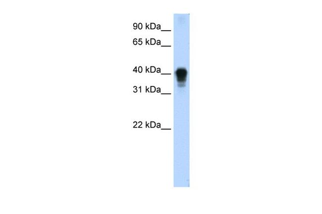 TIA-1 Antibody in Western Blot (WB)