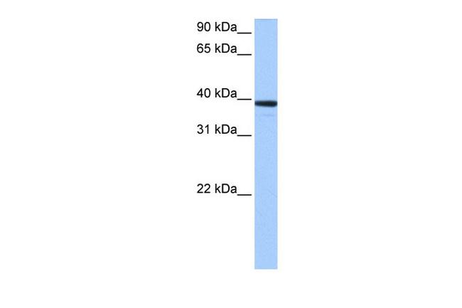 MRM1 Antibody in Western Blot (WB)