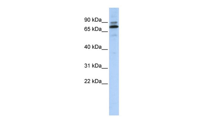 C14orf21 Antibody in Western Blot (WB)