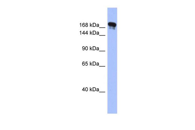 Synaptojanin 1 Antibody in Western Blot (WB)