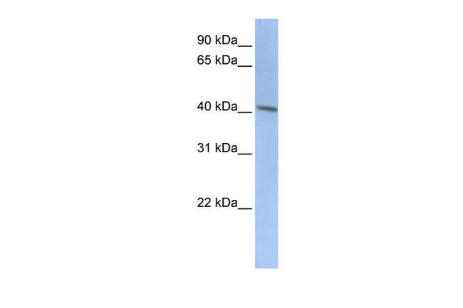 Doublecortin Antibody in Western Blot (WB)