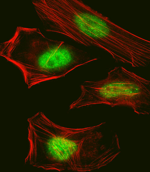 SUMO2/SUMO3 Antibody in Immunocytochemistry (ICC/IF)