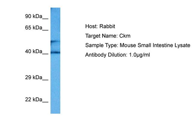 Creatine Kinase MB Antibody in Western Blot (WB)