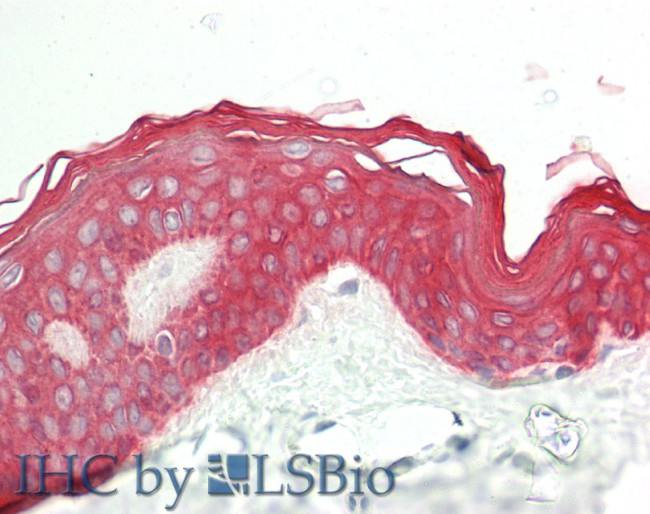 Cytokeratin 2e Antibody in Immunohistochemistry (Paraffin) (IHC (P))