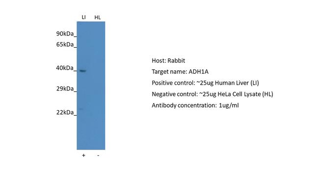 Alcohol Dehydrogenase 1A Antibody in Western Blot (WB)