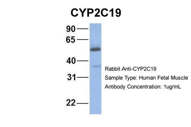 CYP2C19 Antibody in Western Blot (WB)