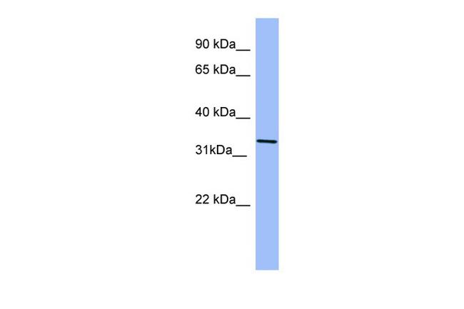 KIR2DL4 Antibody in Western Blot (WB)