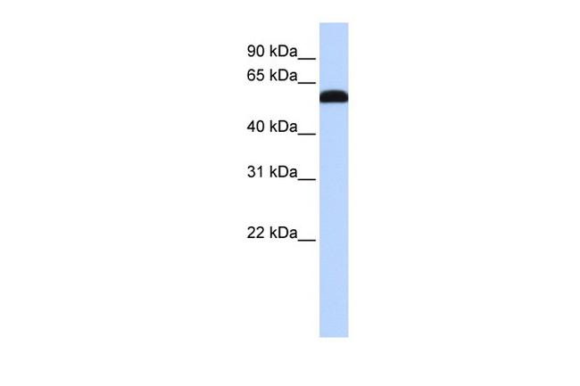 ZGPAT Antibody in Western Blot (WB)