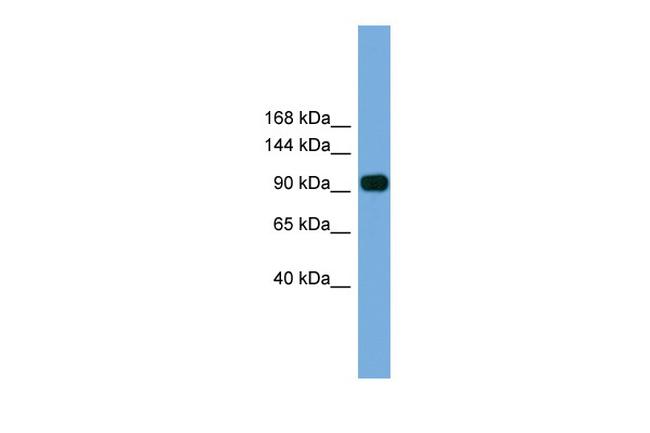 PARP8 Antibody in Western Blot (WB)