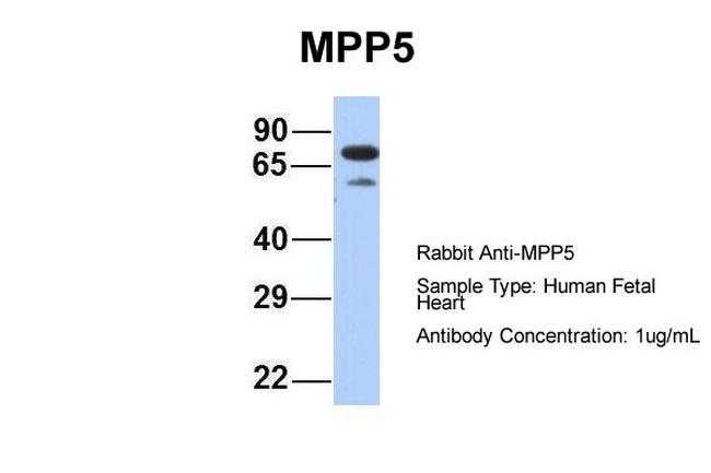 MPP5 Antibody in Western Blot (WB)