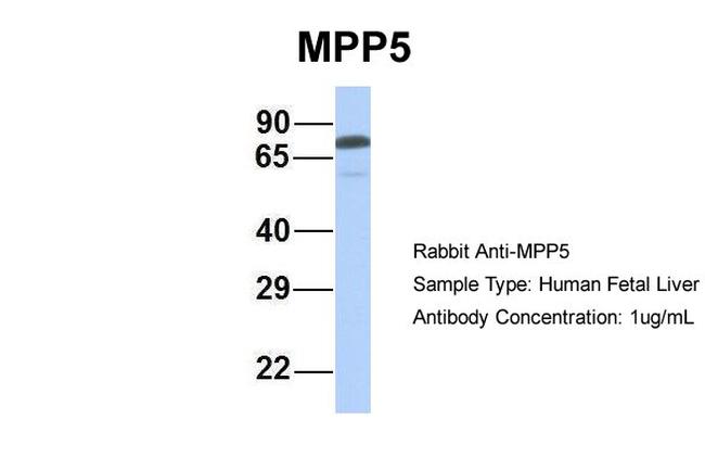 MPP5 Antibody in Western Blot (WB)