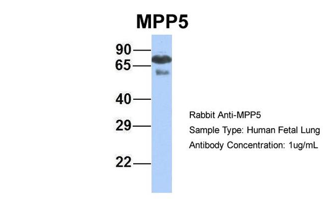 MPP5 Antibody in Western Blot (WB)