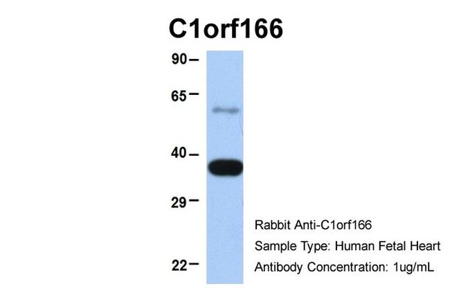 MUL1 Antibody in Western Blot (WB)