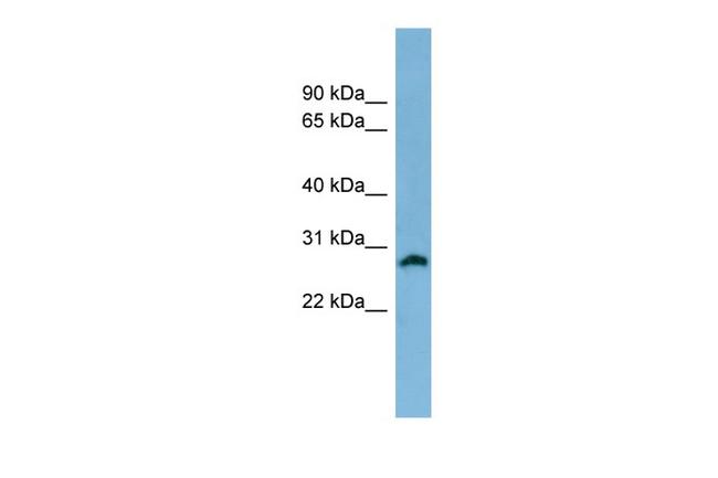 SRD5A2 Antibody in Western Blot (WB)