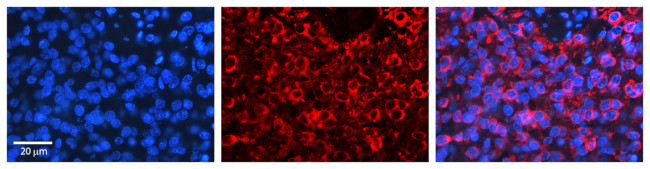 PSEN2 Antibody in Immunohistochemistry (Paraffin) (IHC (P))