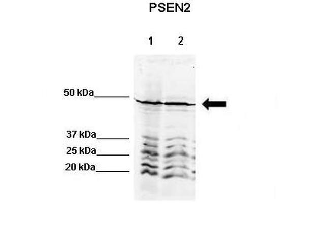 PSEN2 Antibody in Western Blot (WB)