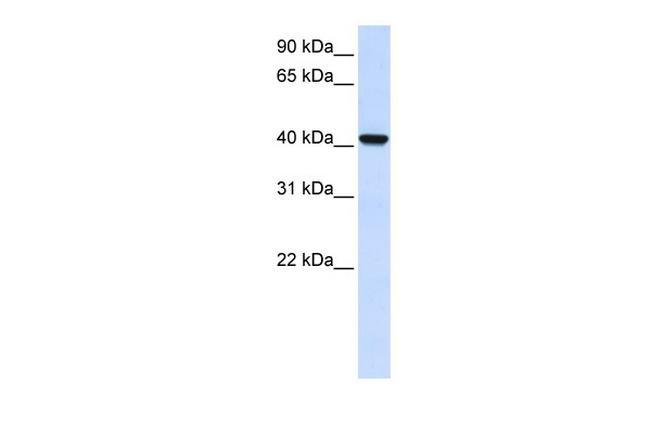 AWAT2 Antibody in Western Blot (WB)