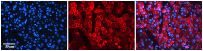 NIPA2 Antibody in Immunohistochemistry (IHC)