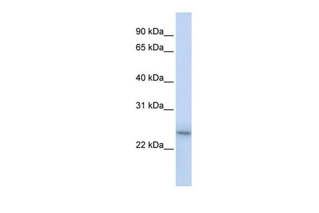 PSMB9 Antibody in Western Blot (WB)