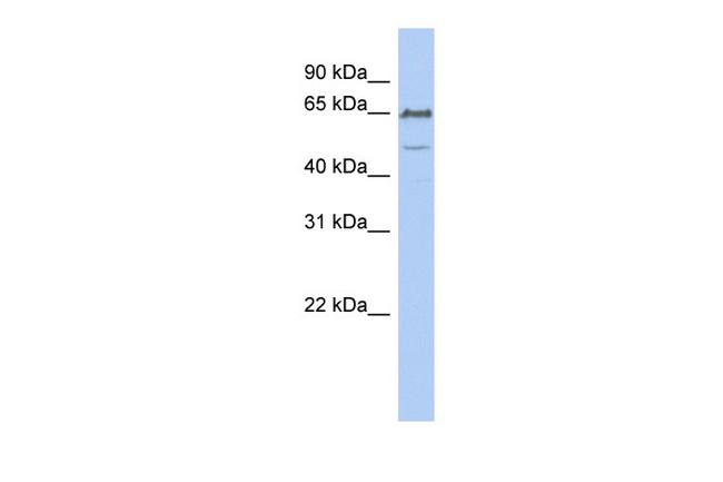 DGCR2 Antibody in Western Blot (WB)