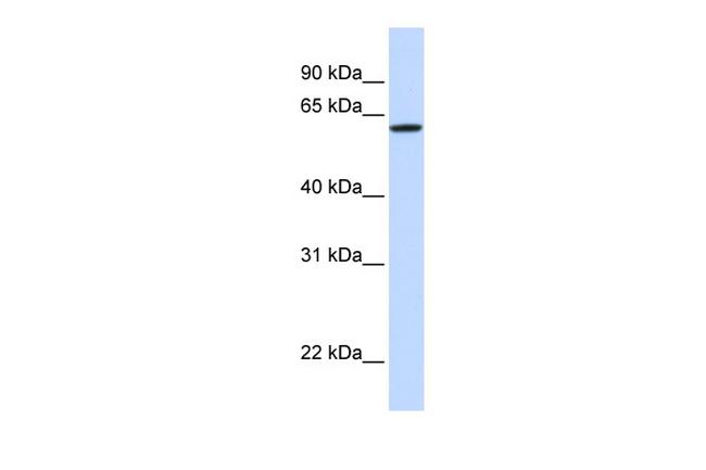 DGCR2 Antibody in Western Blot (WB)