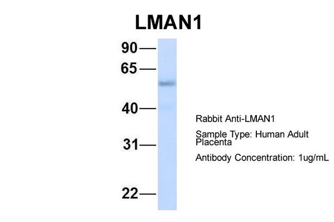 LMAN1 Antibody in Western Blot (WB)