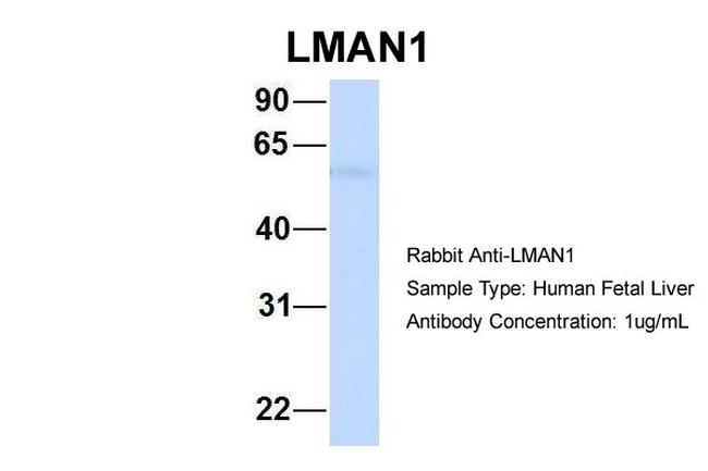 LMAN1 Antibody in Western Blot (WB)