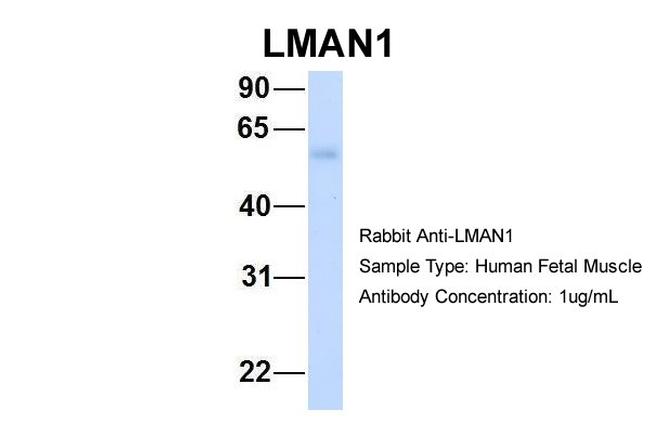 LMAN1 Antibody in Western Blot (WB)