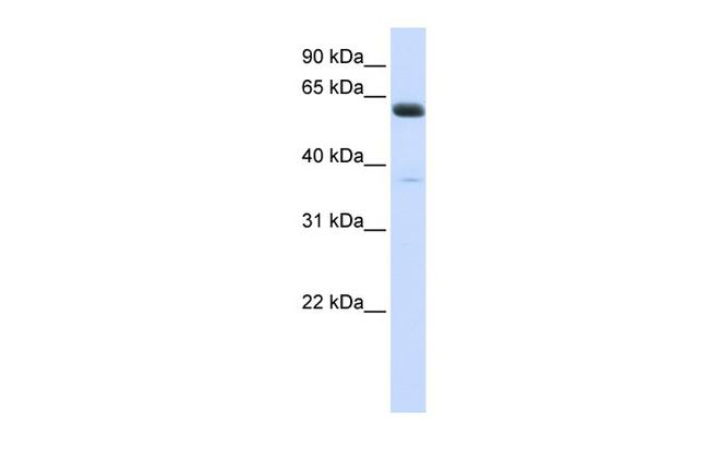 ALG6 Antibody in Western Blot (WB)