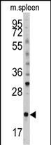 BID Antibody in Western Blot (WB)