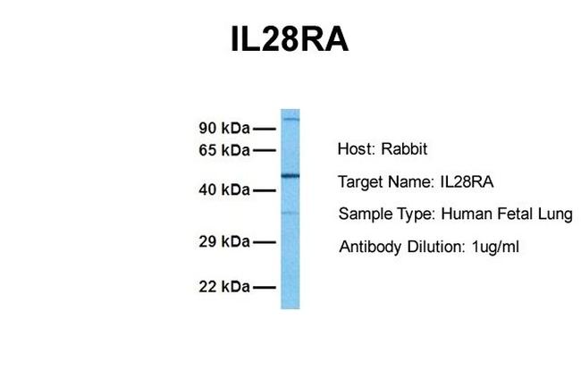 IFNLR1 Antibody in Western Blot (WB)