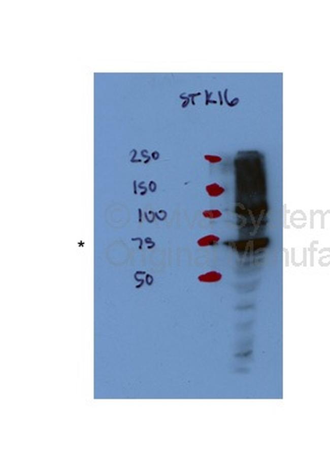 STK16 Antibody in Western Blot (WB)